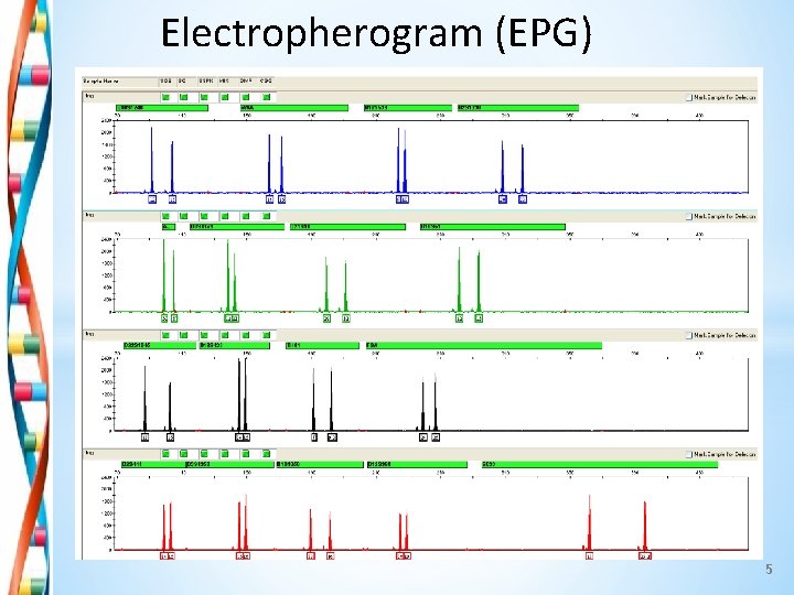 Electropherogram (EPG) 5 