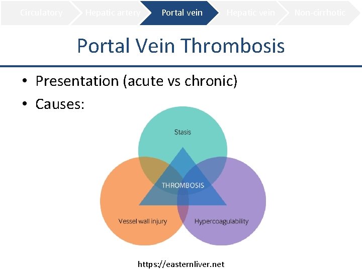 Circulatory Hepatic artery Portal vein Hepatic vein Portal Vein Thrombosis • Presentation (acute vs