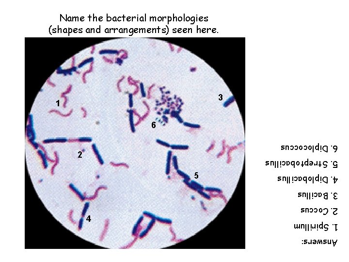 Answers: 1. Spirillum 2. Coccus 4 3. Bacillus 4. Diplobacillus 5. Streptobacillus 5 2