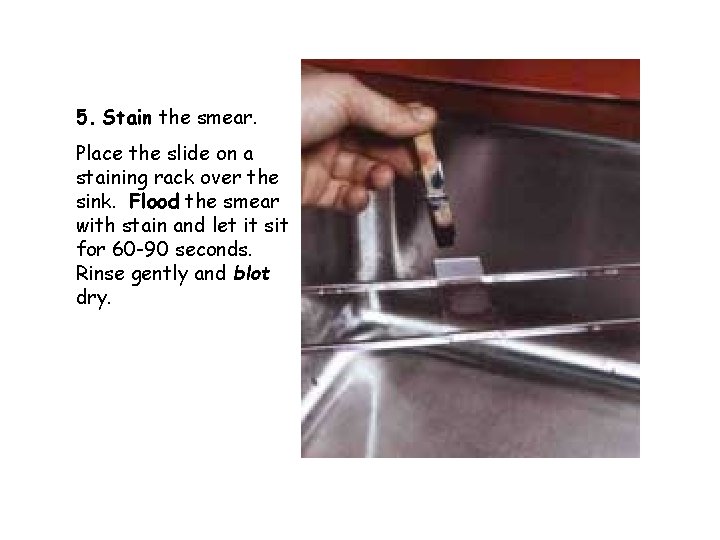 5. Stain the smear. Place the slide on a staining rack over the sink.