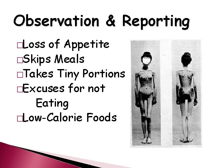 Observation & Reporting �Loss of Appetite �Skips Meals �Takes Tiny Portions �Excuses for not