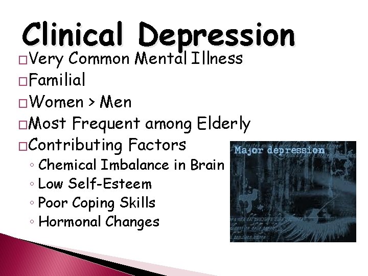 Clinical Depression �Very Common Mental Illness �Familial �Women > Men �Most Frequent among Elderly