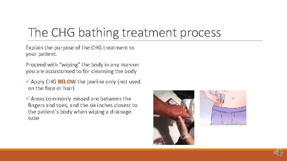 The CHG bathing treatment process Explain the purpose of the CHG treatment to your