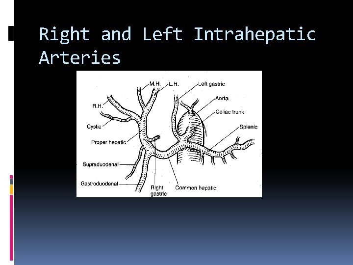 Right and Left Intrahepatic Arteries 