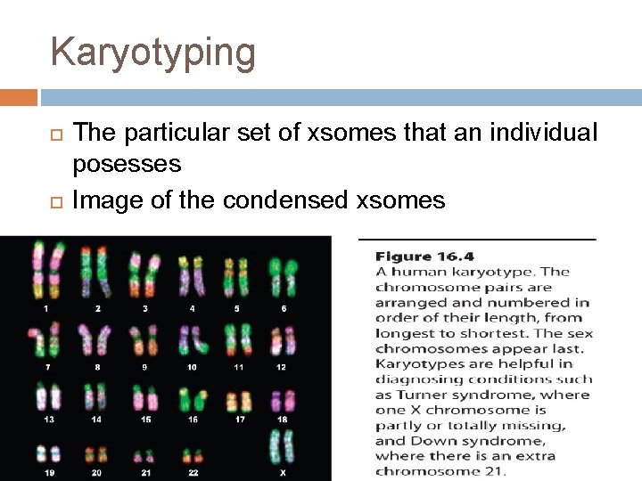 Karyotyping The particular set of xsomes that an individual posesses Image of the condensed