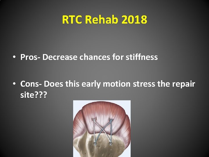 RTC Rehab 2018 • Pros- Decrease chances for stiffness • Cons- Does this early