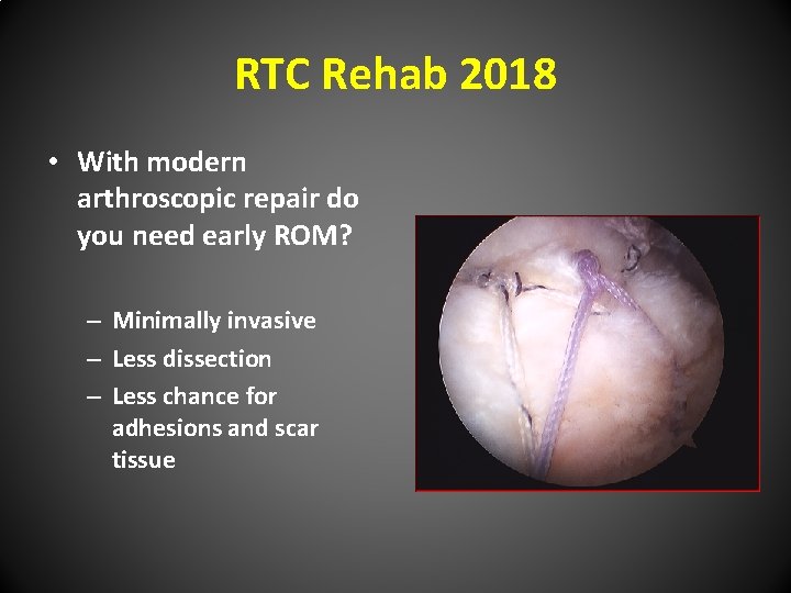 RTC Rehab 2018 • With modern arthroscopic repair do you need early ROM? –
