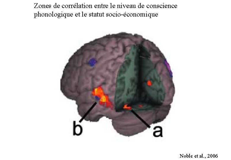 Zones de corrélation entre le niveau de conscience phonologique et le statut socio-économique Noble