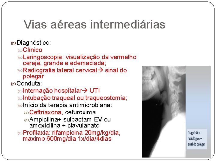 Vias aéreas intermediárias Diagnóstico: Clínico Laringoscopia: visualização da vermelho cereja, grande e edemaciada; Radiografia