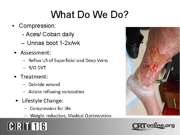 What Do We Do? • Compression: - Aces/ Coban daily – Unnas boot 1