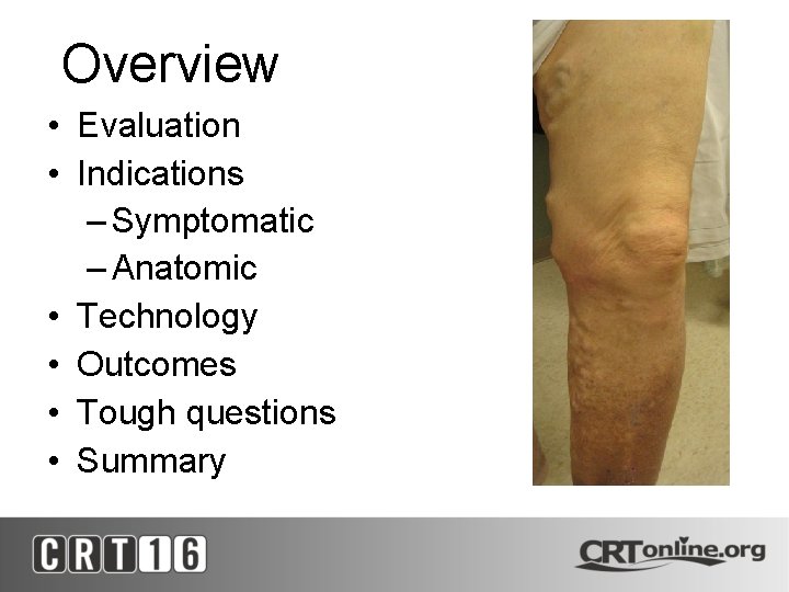 Overview • Evaluation • Indications – Symptomatic – Anatomic • Technology • Outcomes •