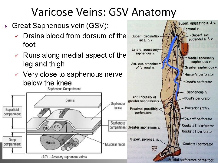 Varicose Veins: GSV Anatomy Ø Great Saphenous vein (GSV): ü Drains blood from dorsum