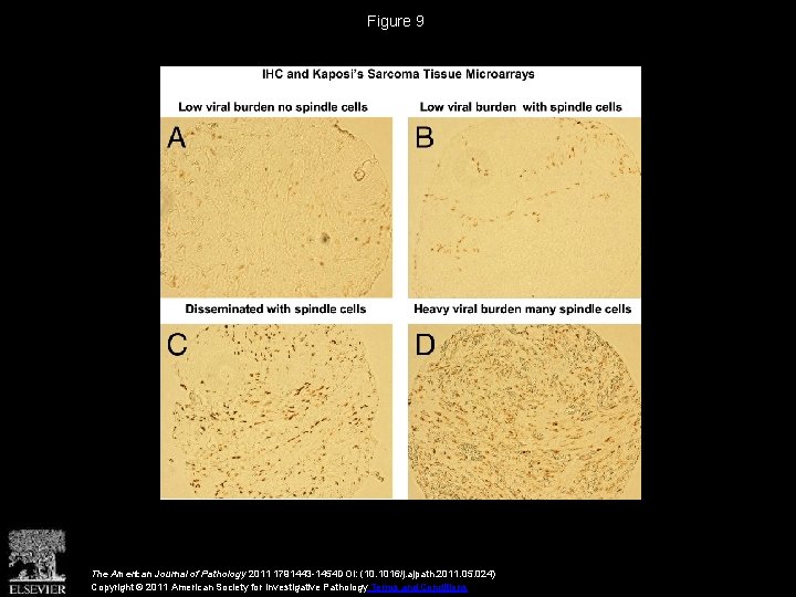 Figure 9 The American Journal of Pathology 2011 1791443 -1454 DOI: (10. 1016/j. ajpath.