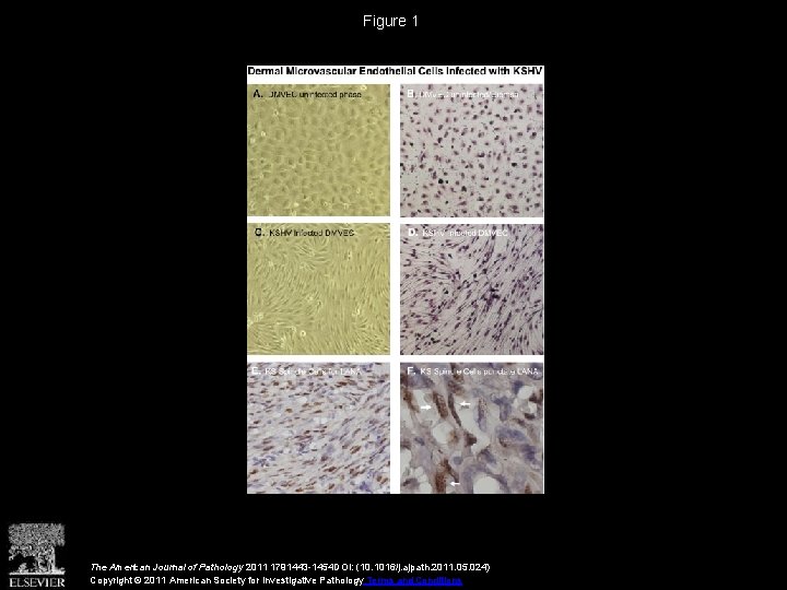 Figure 1 The American Journal of Pathology 2011 1791443 -1454 DOI: (10. 1016/j. ajpath.