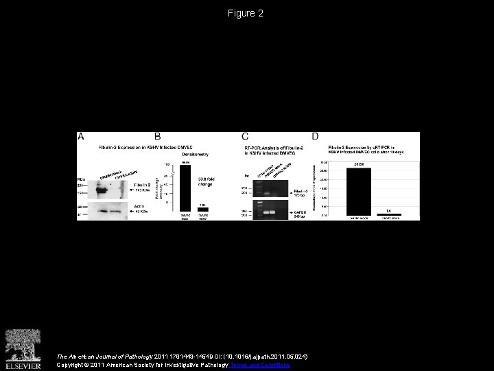 Figure 2 The American Journal of Pathology 2011 1791443 -1454 DOI: (10. 1016/j. ajpath.