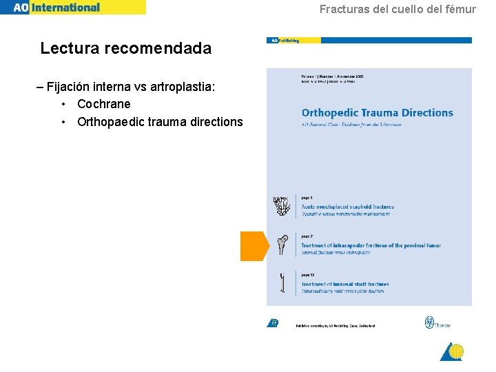 Fracturas del cuello del fémur Lectura recomendada – Fijación interna vs artroplastia: • Cochrane