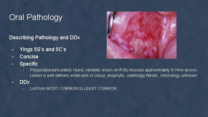 Oral Pathology Describing Pathology and DDx - Yings 5 S’s and 5 C’s Concise
