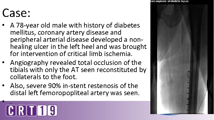 Case: • A 78 -year old male with history of diabetes mellitus, coronary artery