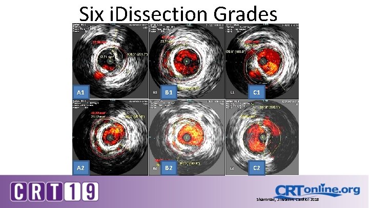 Six i. Dissection Grades A 1 B 1 C 1 A 2 B 2