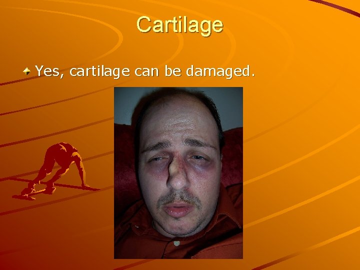 Cartilage Yes, cartilage can be damaged. 