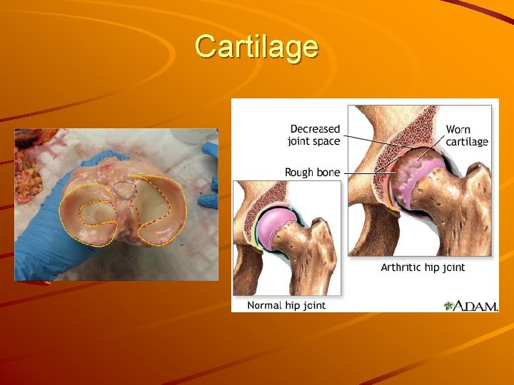 Cartilage 