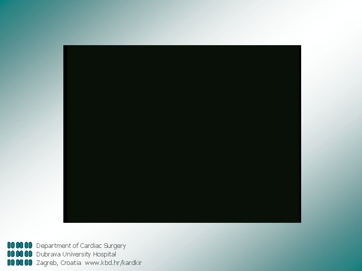 Department of Cardiac Surgery Dubrava University Hospital Zagreb, Croatia www. kbd. hr/kardkir 