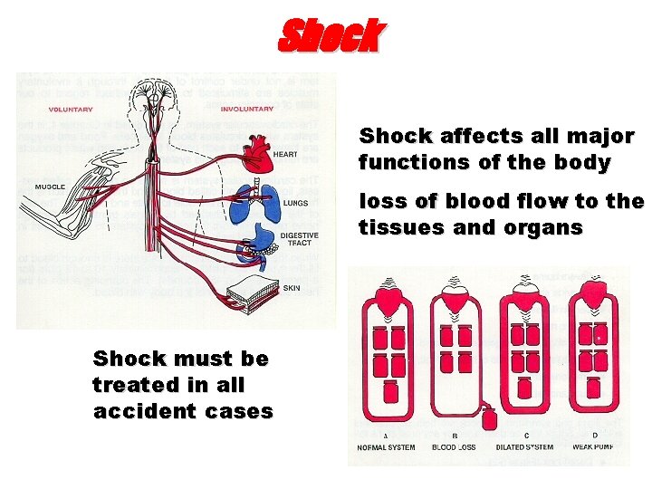 Shock affects all major functions of the body loss of blood flow to the