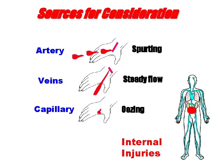 Sources for Consideration Artery Spurting Veins Steady flow Capillary Oozing Internal Injuries 