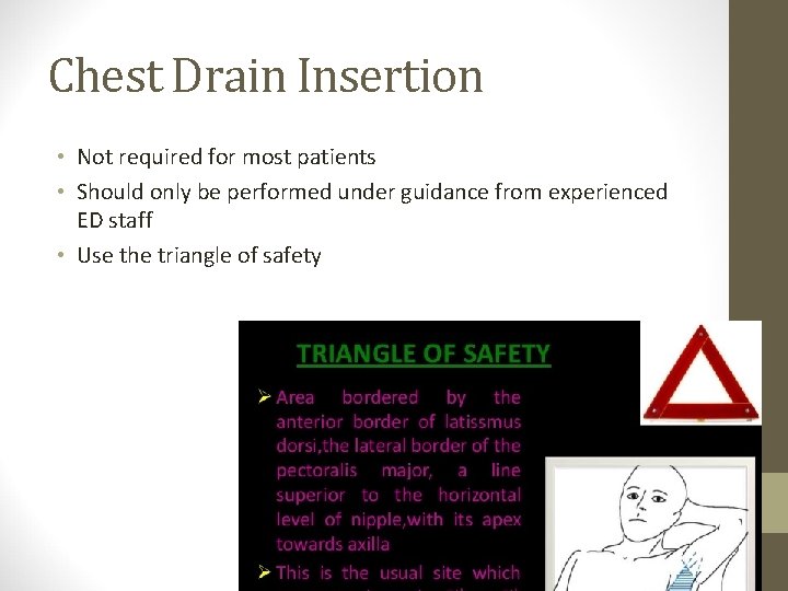 Chest Drain Insertion • Not required for most patients • Should only be performed