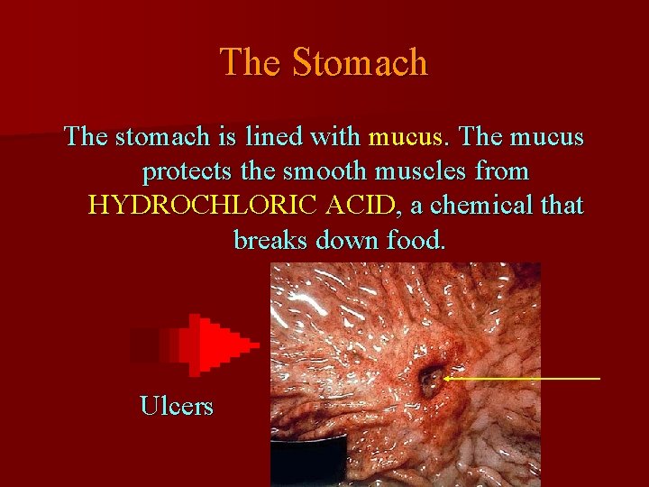 The Stomach The stomach is lined with mucus. The mucus protects the smooth muscles