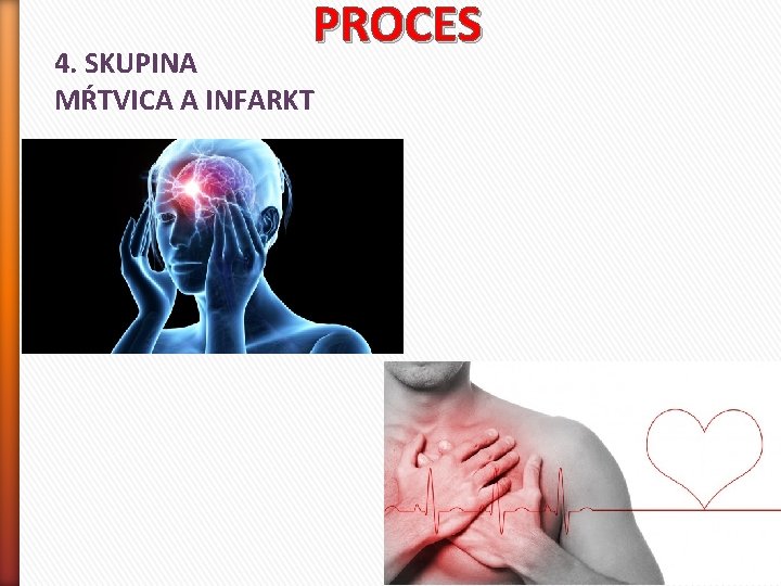 PROCES 4. SKUPINA MŔTVICA A INFARKT 