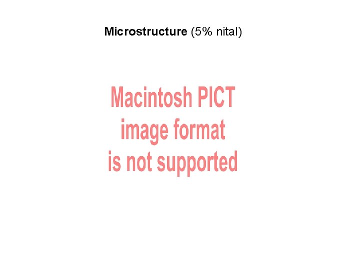 Microstructure (5% nital) 