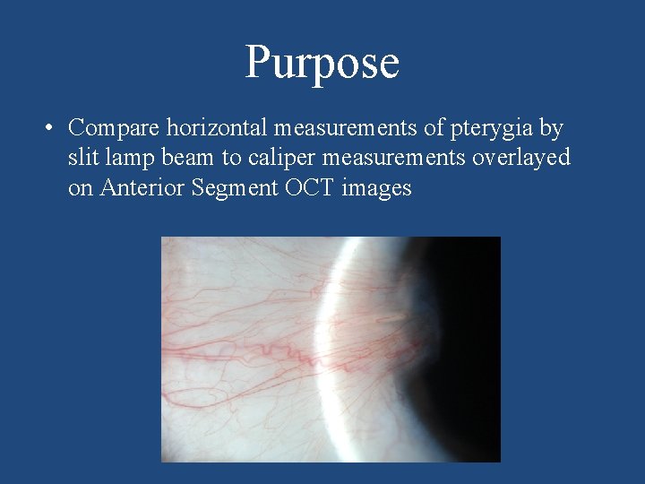 Purpose • Compare horizontal measurements of pterygia by slit lamp beam to caliper measurements