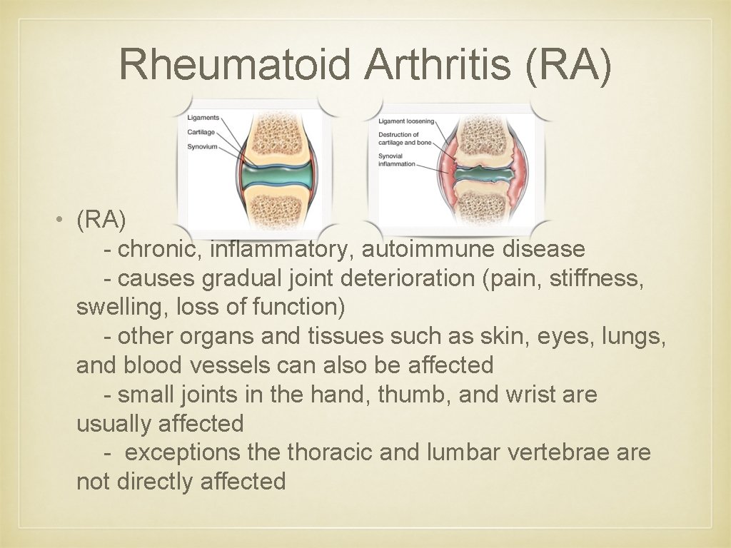 Rheumatoid Arthritis (RA) • (RA) - chronic, inflammatory, autoimmune disease - causes gradual joint