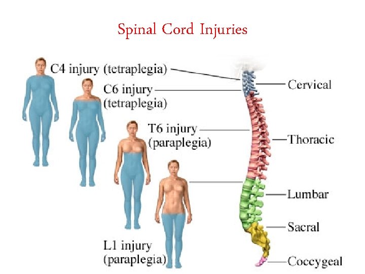 Spinal Cord Injuries 