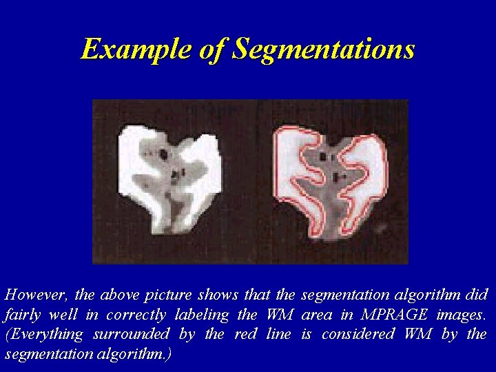 Example of Segmentations However, the above picture shows that the segmentation algorithm did fairly