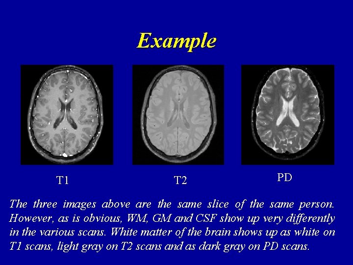 Example T 1 T 2 PD The three images above are the same slice