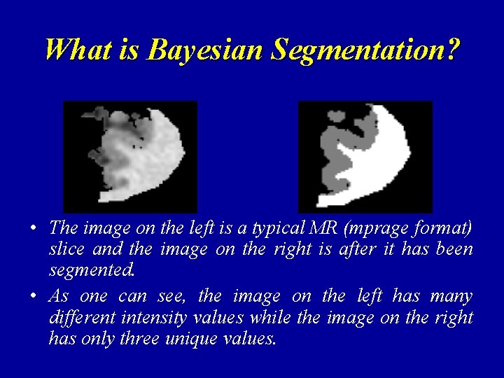 What is Bayesian Segmentation? • The image on the left is a typical MR