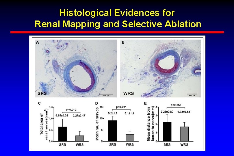Histological Evidences for Renal Mapping and Selective Ablation Histological Evidences for Renal Mapping and Selective Ablation