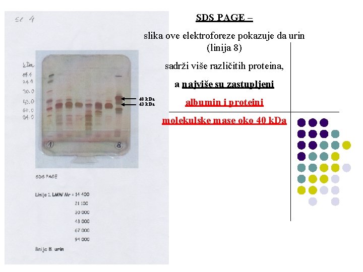 SDS PAGE – slika ove elektroforeze pokazuje da urin (linija 8) sadrži više različitih