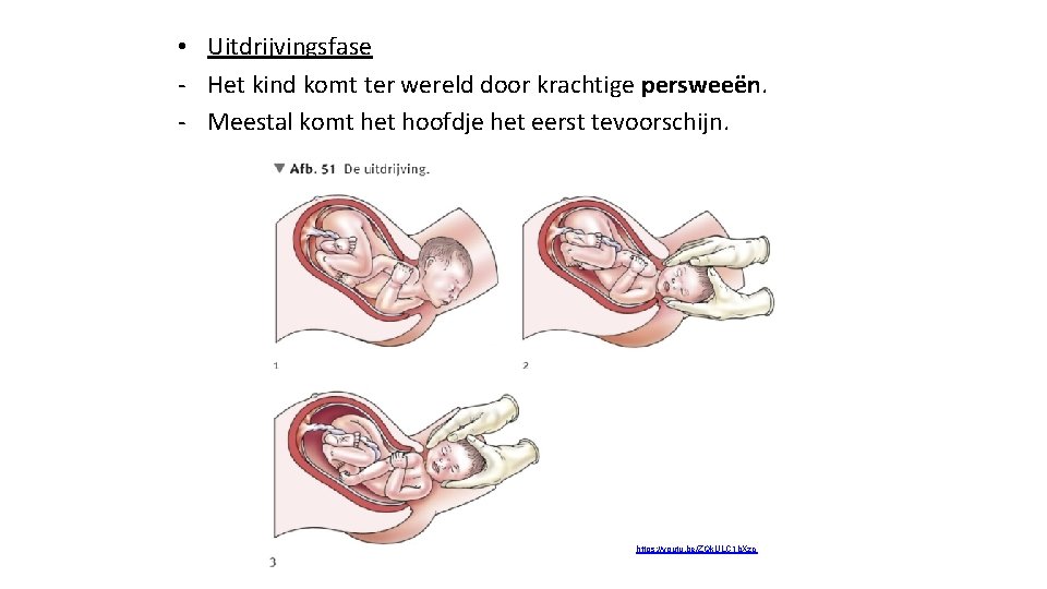  • Uitdrijvingsfase - Het kind komt ter wereld door krachtige persweeën. - Meestal