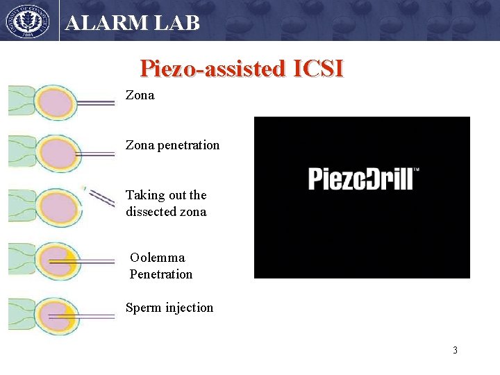 ALARM LAB Piezo-assisted ICSI Zona penetration Taking out the dissected zona Oolemma Penetration Sperm