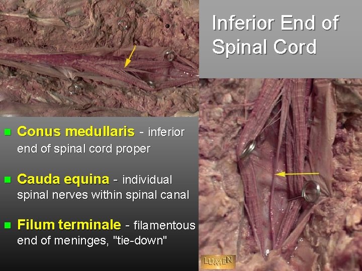 Lecture on Spinal Cord and Spinal Nerves Objectives