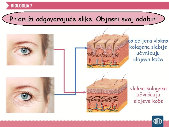 Pridruži odgovarajuće slike. Objasni svoj odabir! oslabljena vlakna kolagena slabije učvršćuju slojeve kože vlakna