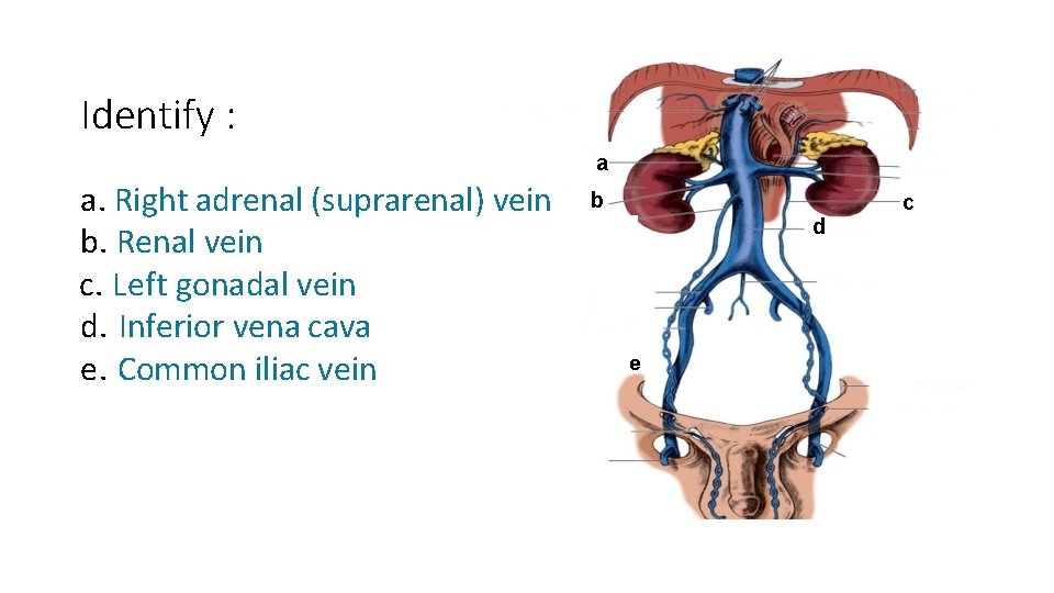 Identify : a a. Right adrenal (suprarenal) vein b. Renal vein c. Left gonadal