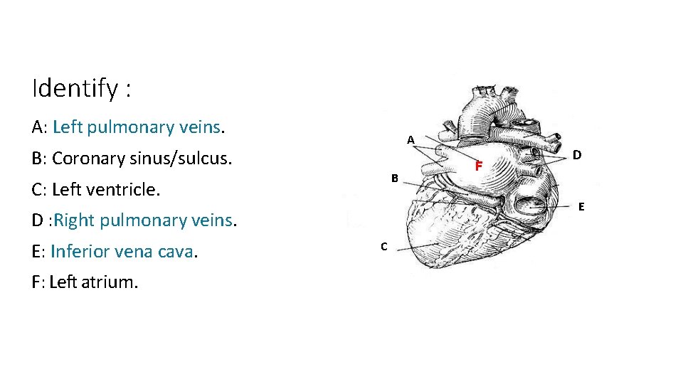 Identify : A: Left pulmonary veins. A B: Coronary sinus/sulcus. B C: Left ventricle.