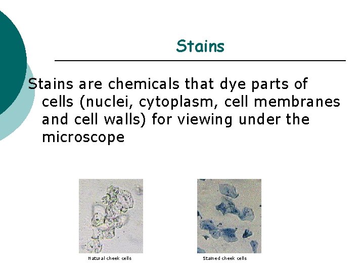 Stains are chemicals that dye parts of cells (nuclei, cytoplasm, cell membranes and cell