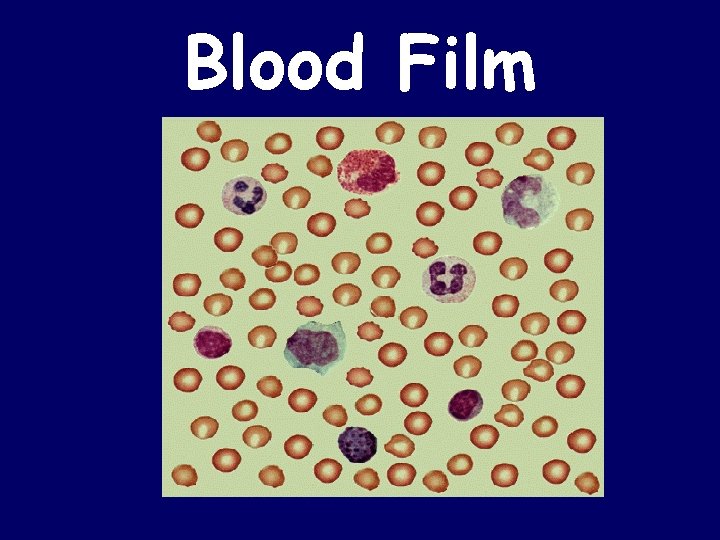 Blood Film 