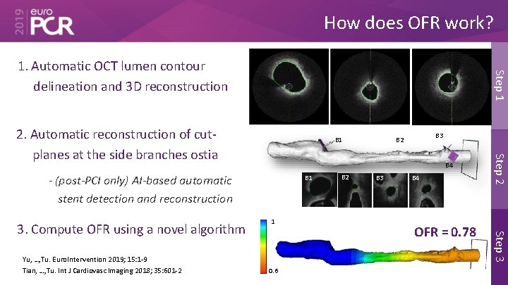 How does OFR work? Step 1 1. Automatic OCT lumen contour delineation and 3
