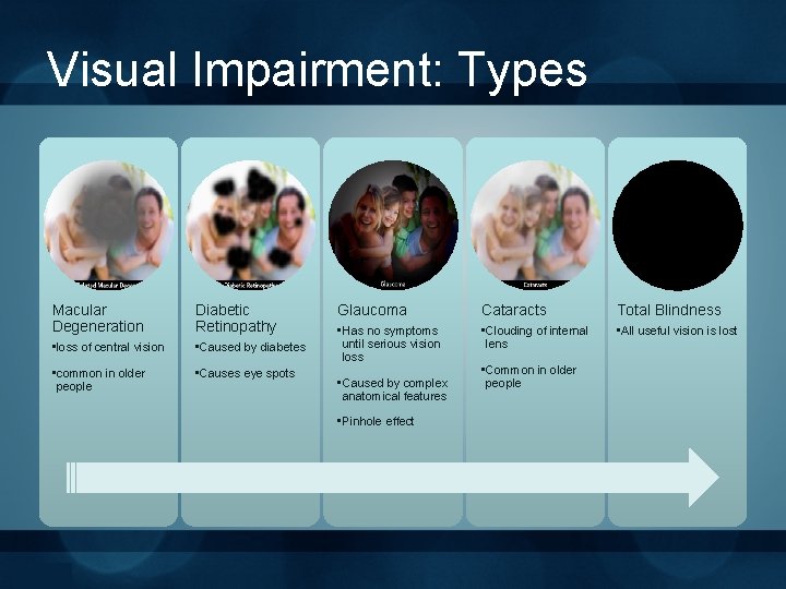 Visual Impairment: Types Macular Degeneration Diabetic Retinopathy • loss of central vision • Caused